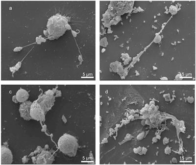 Bovine Polymorphonuclear Neutrophils Cast Neutrophil Extracellular Traps against the Abortive Parasite Neospora caninum